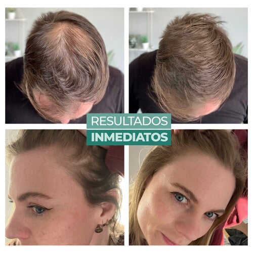 fibras capilares antes y despues